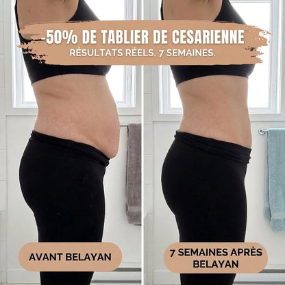 Culotte Post-Partum — Compression 360°